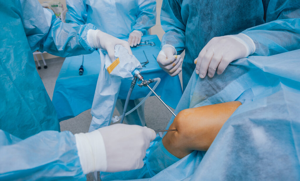 artroscopia di ginocchio - marco spoliti chirurgo ortopedico